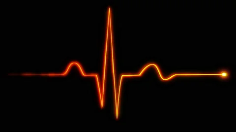 Heartbeat pulse background animation Stock Footage 118434475