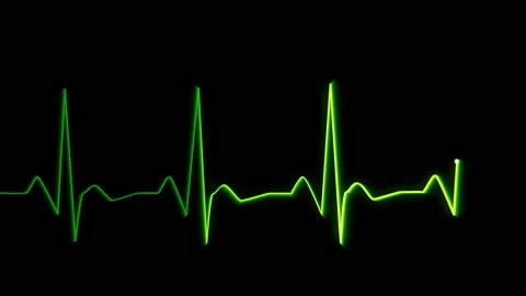 Heartbeat pulse background animation Stock Footage 118544191