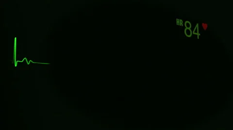 Heartbeat, Pulse, EKG Stock Footage 58688453