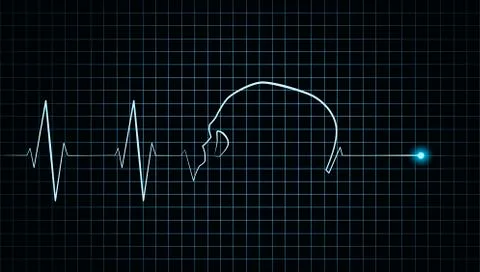 Heartbeat Stop Cardiogram Stock Illustration