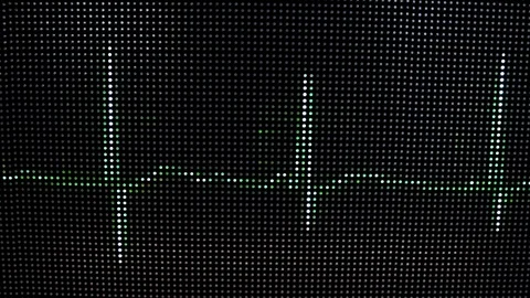 Heartbeat wave on digital display 库存影片 111950575