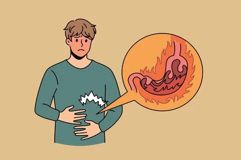 Heartburn and digestive problems concept 库存插图