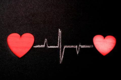 Hearts are connected by a single rhythm. Two hearts on a blackboard with a ch Stock Photos