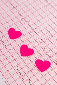 Hearts of paper lying on electrocardiogram graph, ecg heart rhythm, medicin.. Stock Photos