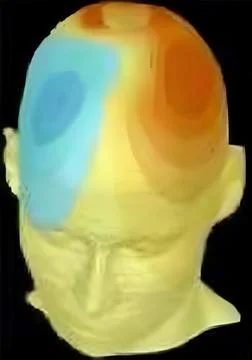 Heatmap Visualization of Neural Activity on a 3D Cranial Model for Advanced.. Stock-Fotos