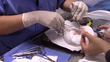 Hedgehog surgery 스톡 동영상 86085265