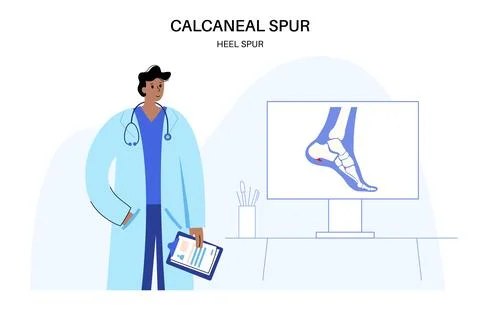 Heel spur poster Illustrazione stock