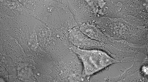 HeLa cells in culture Stock Footage 61910584