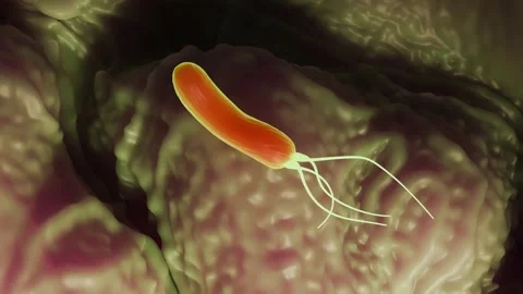 Helicobacter pylori bacteria | Stock Video | Pond5