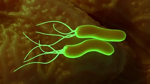 Helicobacter pylori bacteria Stock Footage 305632459