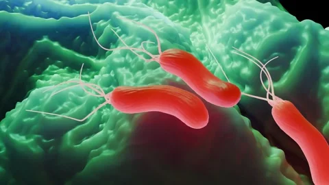 Helicobacter pylori bacteria Stock Footage 305632465