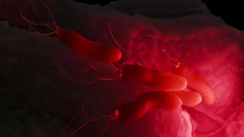 Helicobacter pylori bacteria Stock Footage 305632467