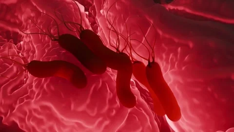 Helicobacter pylori bacteria Stock Footage 305632470