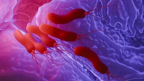 Helicobacter pylori bacteria Stock Footage 305632474