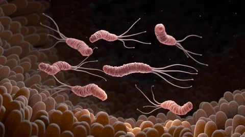 Helicobacter Pylori bacteria in the stom... | Stock Video | Pond5