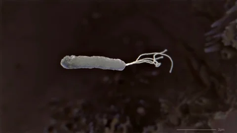 Helicobacter pylori bacterium Stock Footage