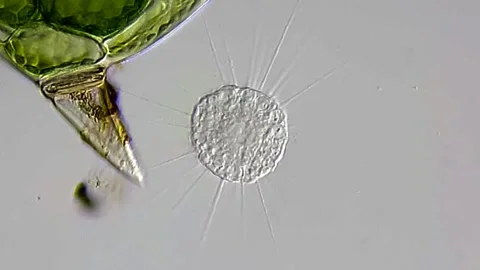 Heliozoa under microscopy view, 400x DIC contrast method 库存影片 306585948