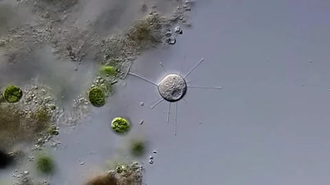 Heliozoa under microscopy view, DIC contrast method 库存影片 306578049