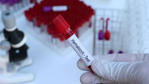 Hematocrit Test To Look For Abnormalitie 