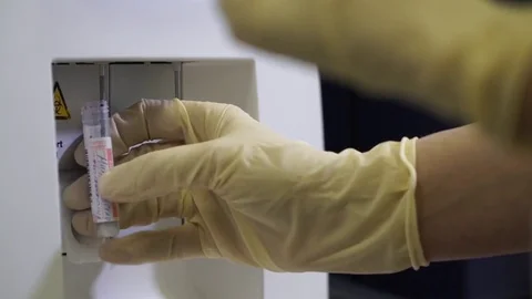 Hematology analyzer. Close-up of female hand's in gloves Stock Footage 70142831