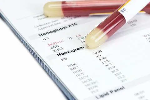 Hematology Report Foto stock
