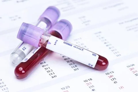 Hematology Report Stock Photos