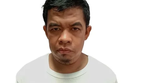 Hemifacial spasm in men Stock Footage 292866802