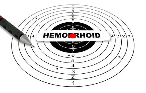 Hemmorhoid Ilustración de archivo