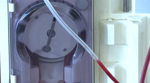 The hemodialysis machine Video stock 62022226