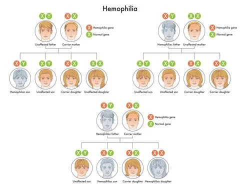 Hemophilia Stock Illustration