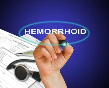 Hemorrhoid Stock Illustration