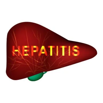 Hepatitis A, B, C, D, E, F, G. World Hepatitis Day. Infographics. Vector Illustrazione stock
