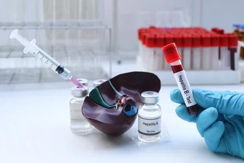 Hepatitis B test to look for abnormalities from blood Stock Photos