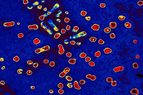  Hepatitis b virus Electronic microscope x150000. Copyright: xCAVALLINIxJA... Photos