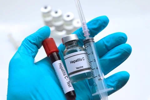 Hepatitis C test to look for abnormalities from blood Stock Photos