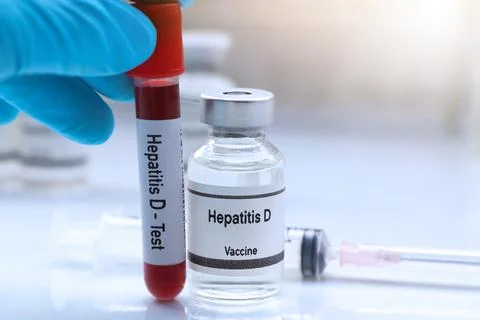 Hepatitis D test to look for abnormalities from blood Stockfoto's