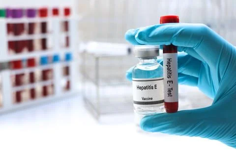 Hepatitis E test to look for abnormalities from blood Stockfoto's