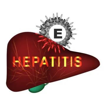 Hepatitis E. World Hepatitis Day. Infographics. Vector illustration on isolated Stock Illustration
