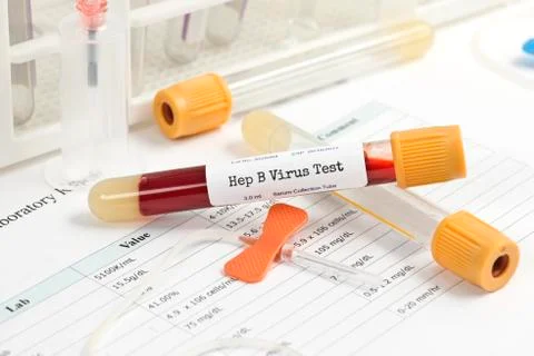 Hepatitis Test Stock Photos