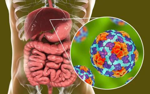 Hepatitis A viruses in liver Stock Illustration