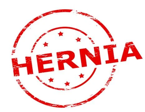 Hernia Stock Illustration