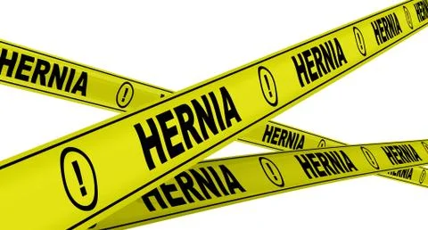 HERNIA. Yellow warning tapes Ilustração Stock