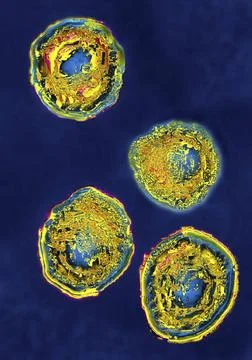  Herpes simplex virus type 2 Herpes simplex virus type 2 (HSV2). Image HDR... Stock Photos