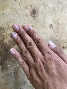 Hidden Mess Beneath the Nails Stock Photos