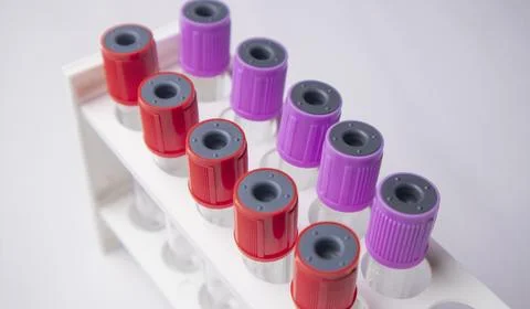 High-angle, close-up shot of multiple medical blood collection tubes with r.. Stock Photos