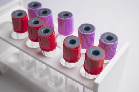 High-angle, close-up shot of multiple medical blood collection tubes with r.. Stock Photos