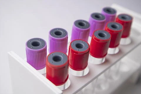 High-angle, close-up shot of multiple medical blood collection tubes with r.. Stock Photos