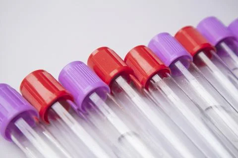 High-angle, close-up shot of several empty medical blood collection tubes w.. Stock Photos