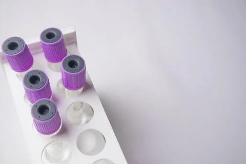 High-angle, overhead shot of four empty medical blood collection tubes with.. Stock Photos