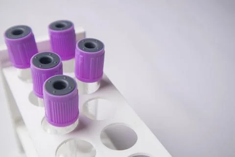 High-angle, overhead shot of four empty medical blood collection tubes with.. Stock Photos